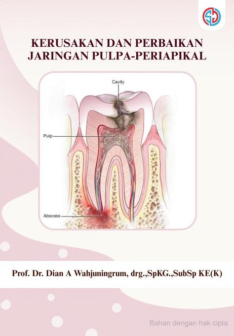 KERUSAKAN DAN PERBAIKAN JARINGAN PULPA-PERIAPIKAL